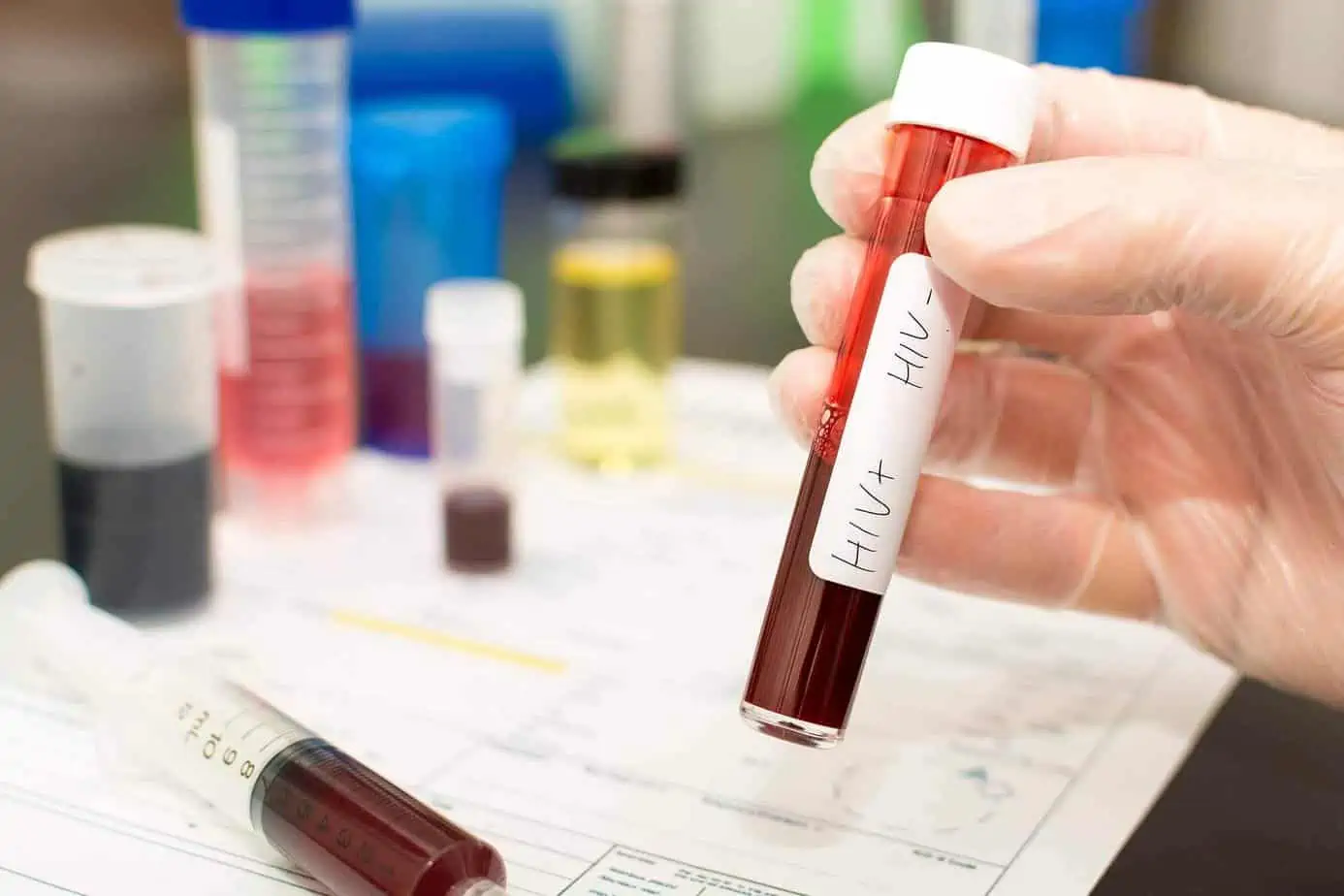 Gloved nurse's hand performing an HIV blood test for medical examination